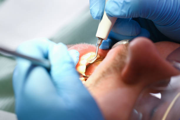 Best Mobile Emergency Dentist in Armonk, NY